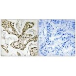 Immunohistochemistry - TOP2A Antibody from Signalway Antibody (33671) - Antibodies.com