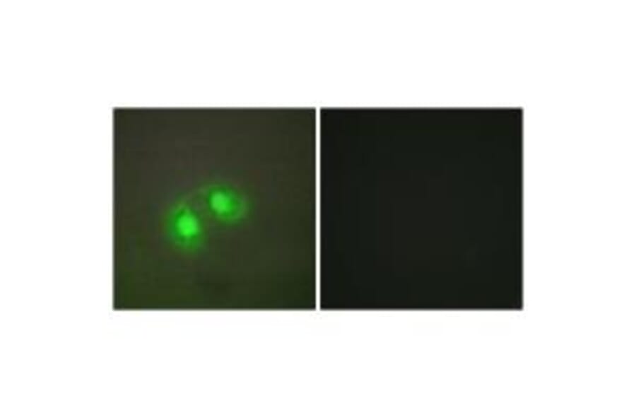 Immunofluorescence - TOP2A Antibody from Signalway Antibody (33671) - Antibodies.com