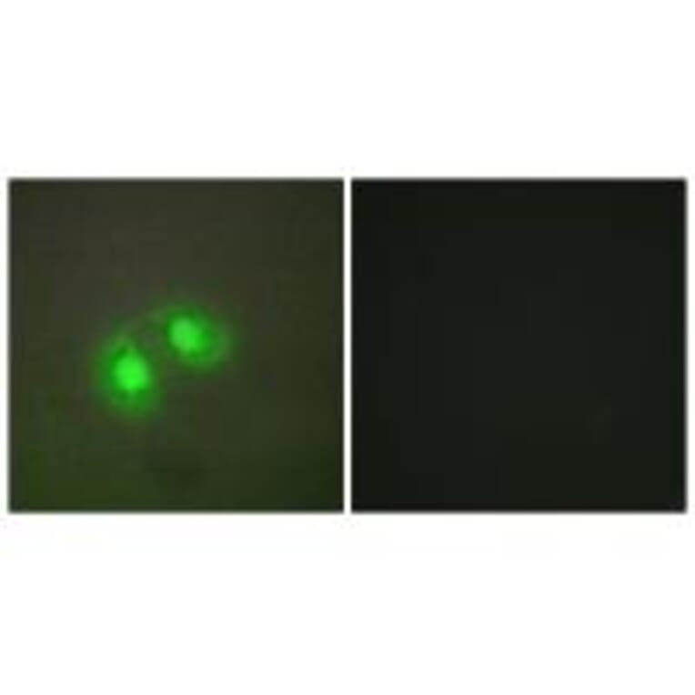 Immunofluorescence - TOP2A Antibody from Signalway Antibody (33671) - Antibodies.com