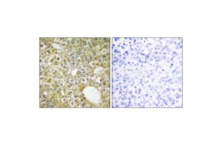 Immunohistochemistry - ACVL1 Antibody from Signalway Antibody (33762) - Antibodies.com