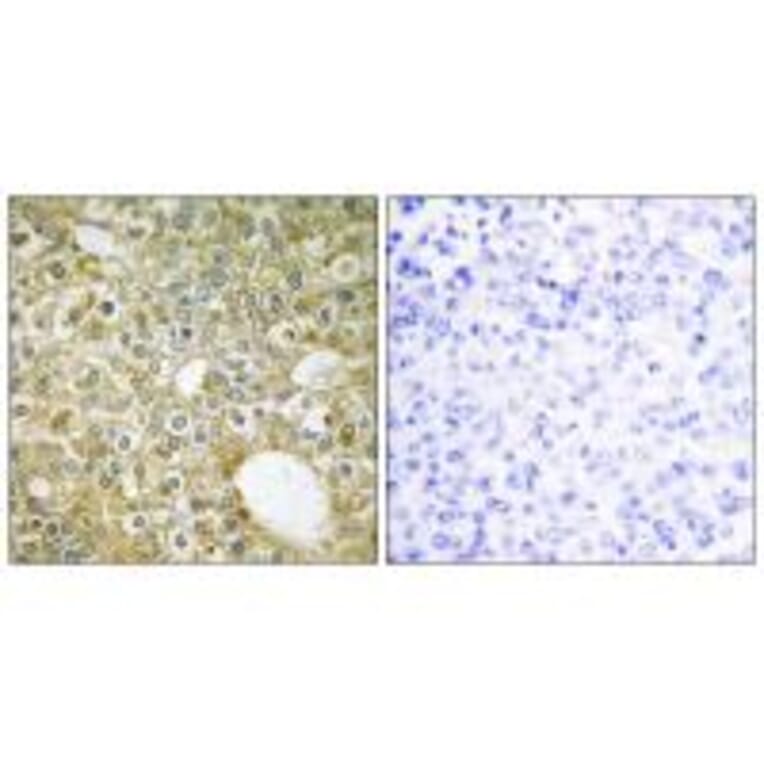 Immunohistochemistry - ACVL1 Antibody from Signalway Antibody (33762) - Antibodies.com