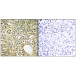 Immunohistochemistry - ACVL1 Antibody from Signalway Antibody (33762) - Antibodies.com