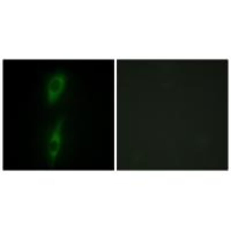 Immunofluorescence - ACVL1 Antibody from Signalway Antibody (33762) - Antibodies.com