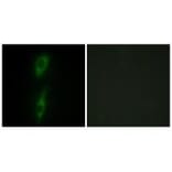 Immunofluorescence - ACVL1 Antibody from Signalway Antibody (33762) - Antibodies.com