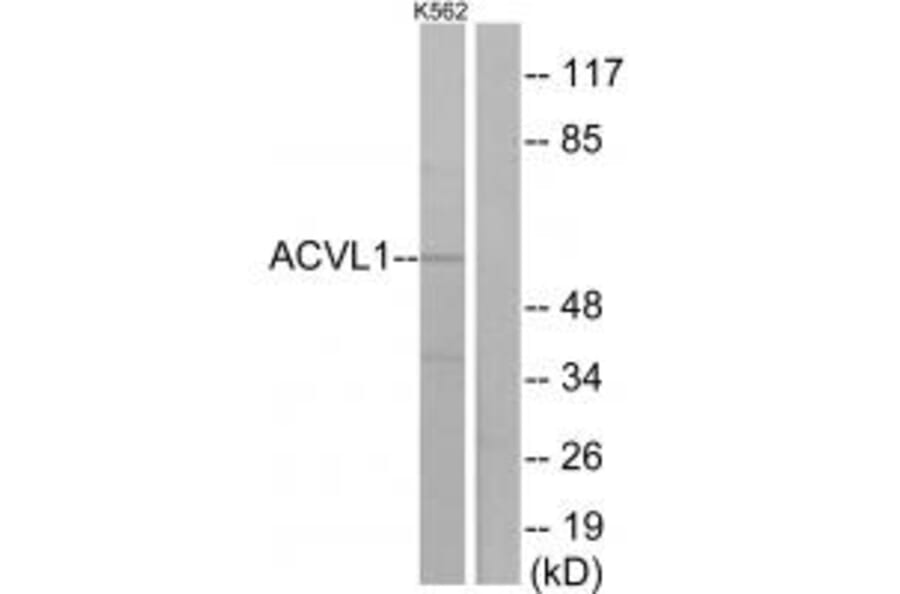 Western blot - ACVL1 Antibody from Signalway Antibody (33762) - Antibodies.com