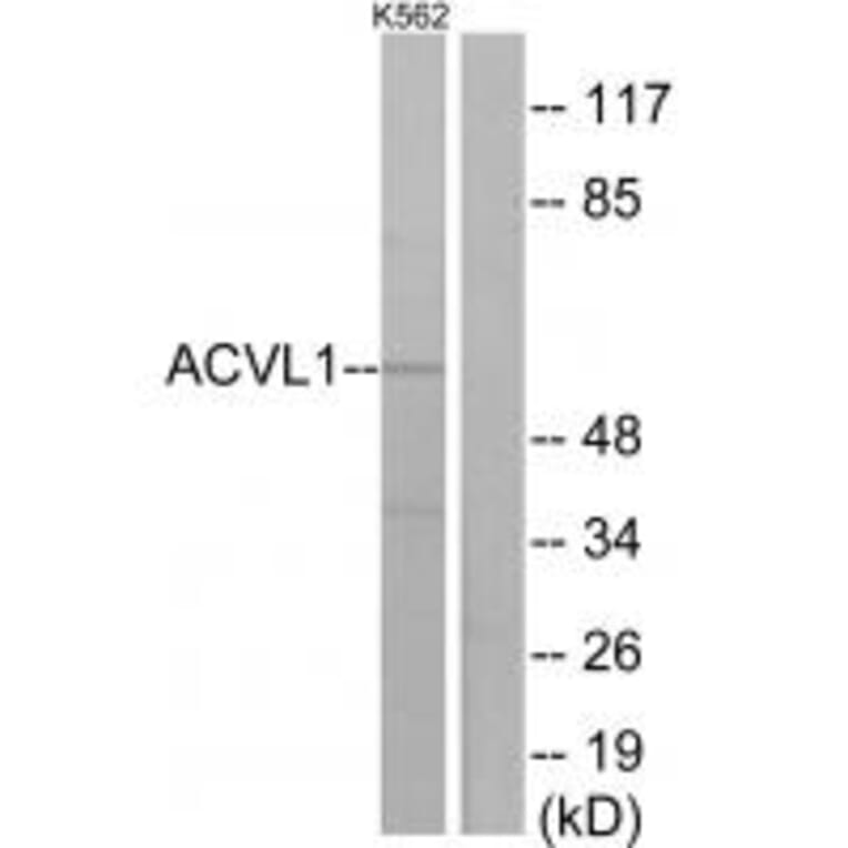 Western blot - ACVL1 Antibody from Signalway Antibody (33762) - Antibodies.com