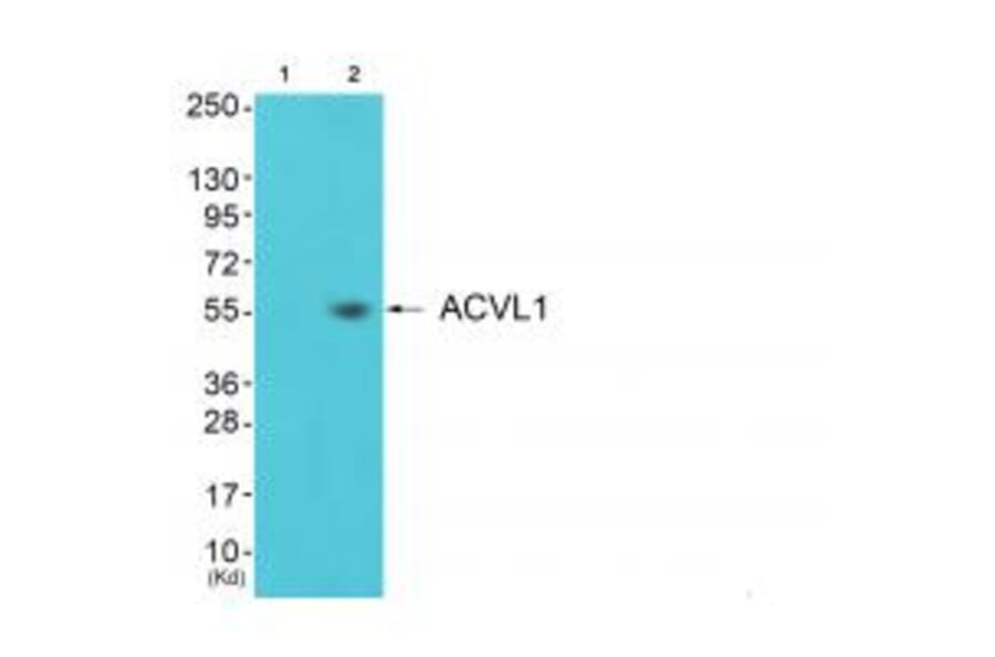 Western blot - ACVL1 Antibody from Signalway Antibody (33762) - Antibodies.com