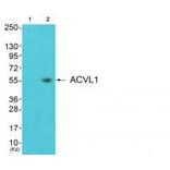 Western blot - ACVL1 Antibody from Signalway Antibody (33762) - Antibodies.com