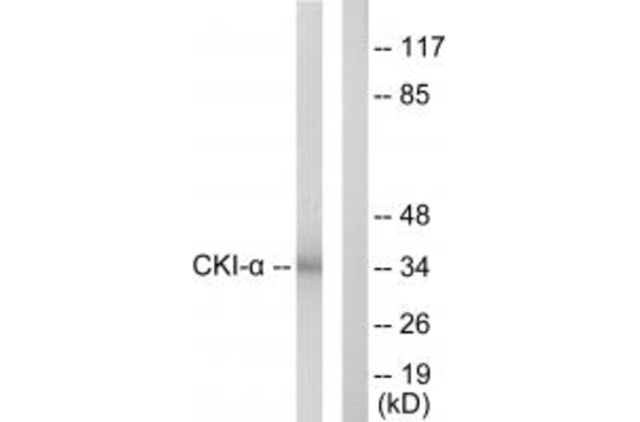 Western blot - CKI-α Antibody from Signalway Antibody (33780) - Antibodies.com