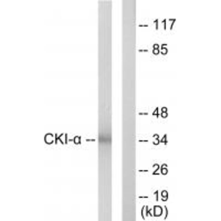 Western blot - CKI-α Antibody from Signalway Antibody (33780) - Antibodies.com