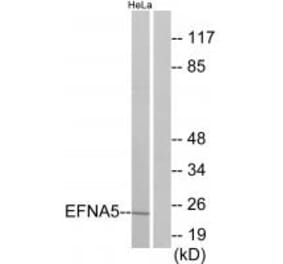 Western blot - EFNA5 Antibody from Signalway Antibody (33811) - Antibodies.com