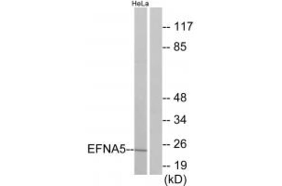 Western blot - EFNA5 Antibody from Signalway Antibody (33811) - Antibodies.com