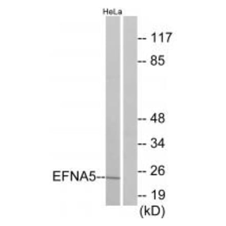 Western blot - EFNA5 Antibody from Signalway Antibody (33811) - Antibodies.com