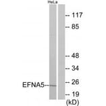 Western blot - EFNA5 Antibody from Signalway Antibody (33811) - Antibodies.com