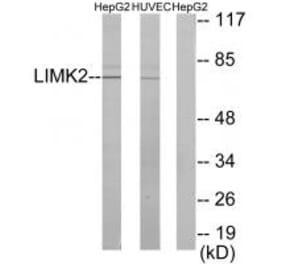 Western blot - LIMK2 Antibody from Signalway Antibody (33815) - Antibodies.com