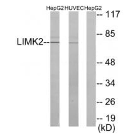 Western blot - LIMK2 Antibody from Signalway Antibody (33815) - Antibodies.com