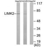 Western blot - LIMK2 Antibody from Signalway Antibody (33815) - Antibodies.com