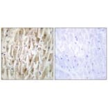 Immunohistochemistry - LIMK2 Antibody from Signalway Antibody (33815) - Antibodies.com