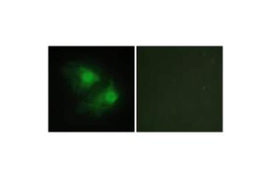 Immunofluorescence - LIMK2 Antibody from Signalway Antibody (33815) - Antibodies.com