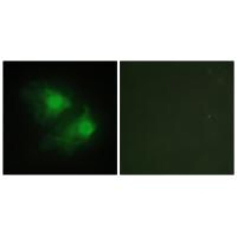 Immunofluorescence - LIMK2 Antibody from Signalway Antibody (33815) - Antibodies.com
