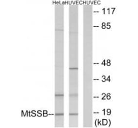 Western blot - MtSSB Antibody from Signalway Antibody (33857) - Antibodies.com