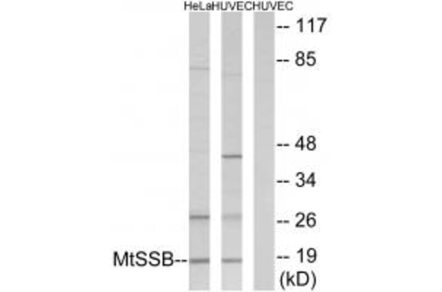 Western blot - MtSSB Antibody from Signalway Antibody (33857) - Antibodies.com
