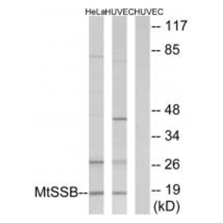 Western blot - MtSSB Antibody from Signalway Antibody (33857) - Antibodies.com