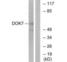 Western blot - DOK7 Antibody from Signalway Antibody (33918) - Antibodies.com