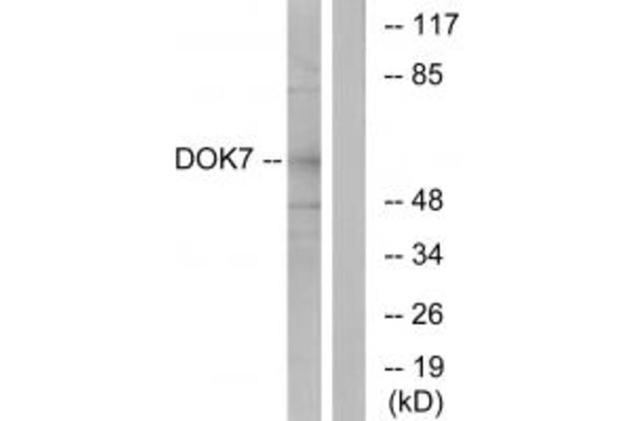 Western blot - DOK7 Antibody from Signalway Antibody (33918) - Antibodies.com