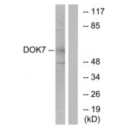 Western blot - DOK7 Antibody from Signalway Antibody (33918) - Antibodies.com