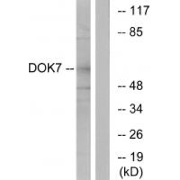 Western blot - DOK7 Antibody from Signalway Antibody (33918) - Antibodies.com