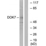 Western blot - DOK7 Antibody from Signalway Antibody (33918) - Antibodies.com
