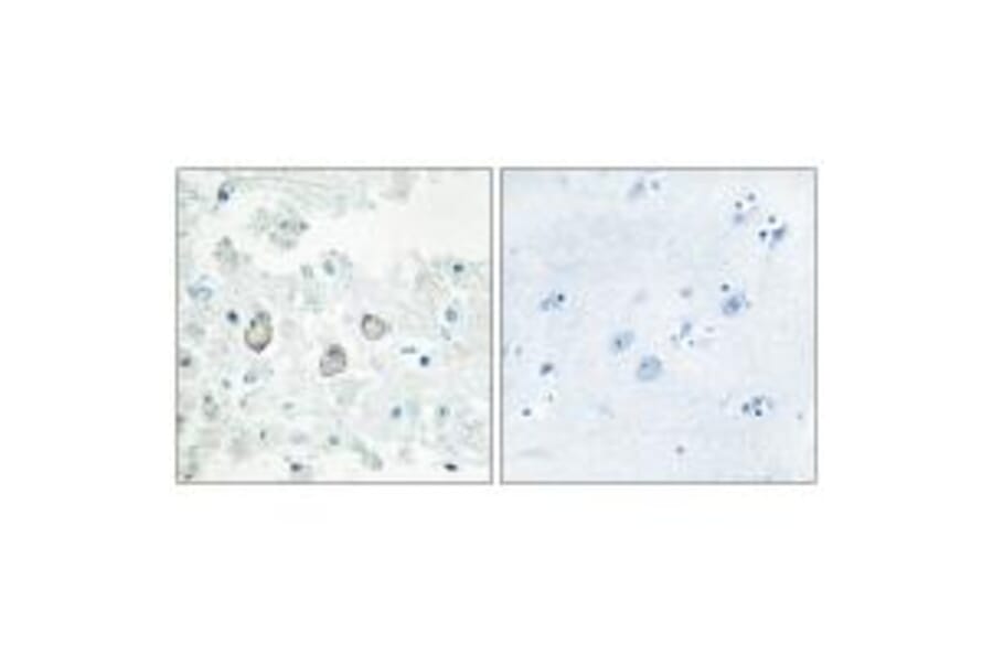 Immunohistochemistry - DOK7 Antibody from Signalway Antibody (33918) - Antibodies.com