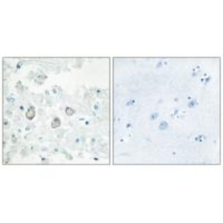 Immunohistochemistry - DOK7 Antibody from Signalway Antibody (33918) - Antibodies.com