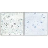 Immunohistochemistry - DOK7 Antibody from Signalway Antibody (33918) - Antibodies.com
