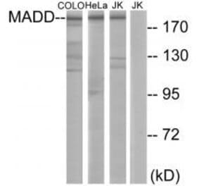 Western blot - MADD Antibody from Signalway Antibody (33997) - Antibodies.com