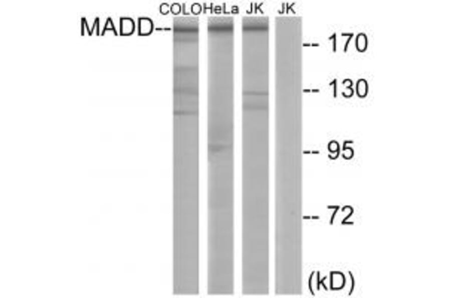 Western blot - MADD Antibody from Signalway Antibody (33997) - Antibodies.com