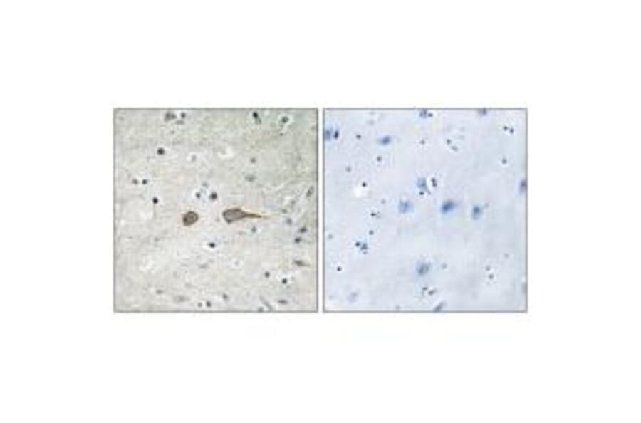 Immunohistochemistry - MADD Antibody from Signalway Antibody (33997) - Antibodies.com