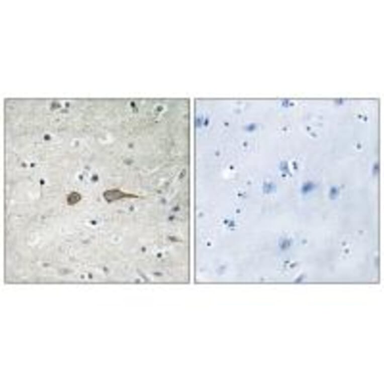 Immunohistochemistry - MADD Antibody from Signalway Antibody (33997) - Antibodies.com