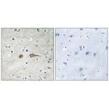 Immunohistochemistry - MADD Antibody from Signalway Antibody (33997) - Antibodies.com