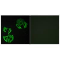 Immunofluorescence analysis of A549 cells, using MADD antibody #33997.