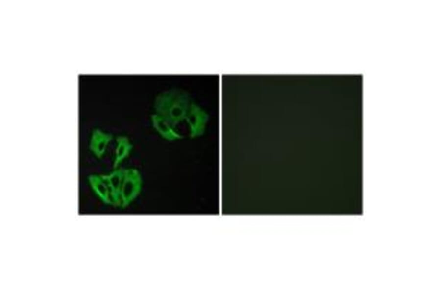 Immunofluorescence - MADD Antibody from Signalway Antibody (33997) - Antibodies.com