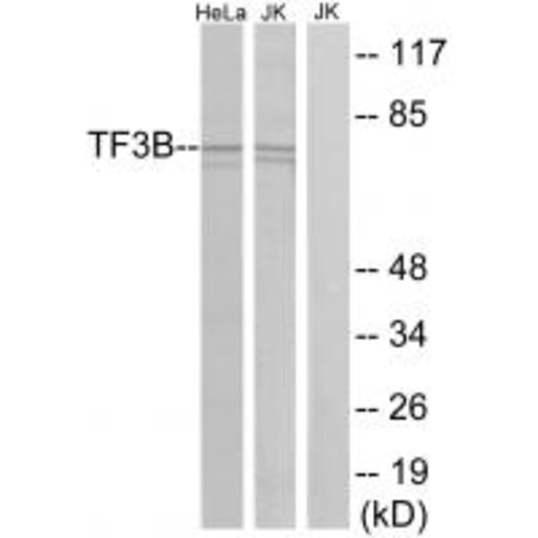 Western blot - TF3B Antibody from Signalway Antibody (34013) - Antibodies.com