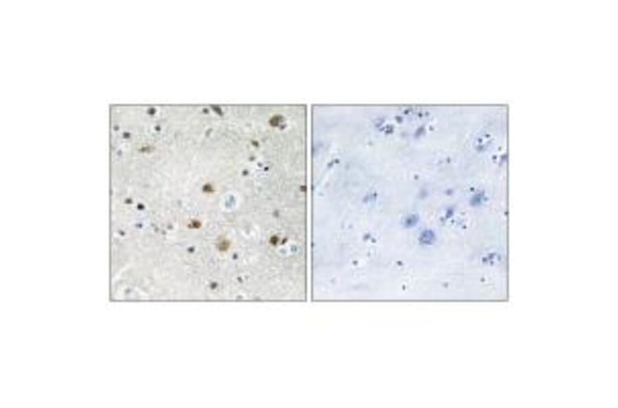 Immunohistochemistry - TF3B Antibody from Signalway Antibody (34013) - Antibodies.com