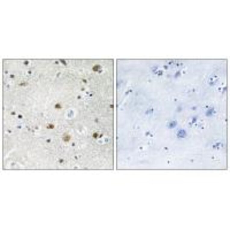 Immunohistochemistry - TF3B Antibody from Signalway Antibody (34013) - Antibodies.com