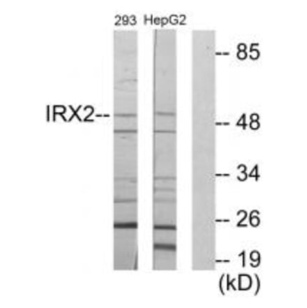 Western blot - IRX2 Antibody from Signalway Antibody (34053) - Antibodies.com