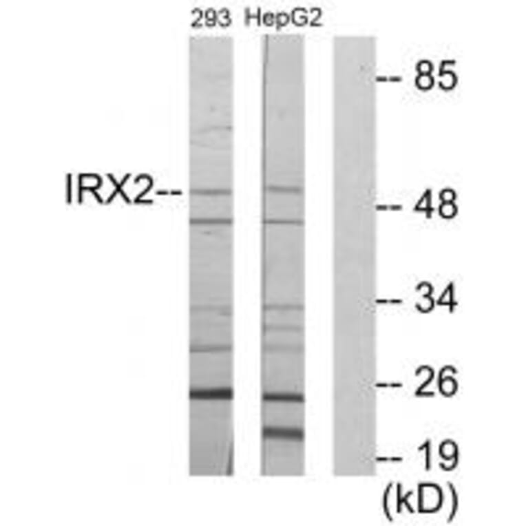 Western blot - IRX2 Antibody from Signalway Antibody (34053) - Antibodies.com