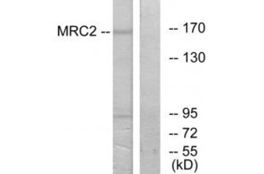 Western blot - MRC2 Antibody from Signalway Antibody (34093) - Antibodies.com