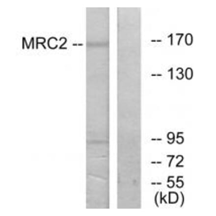 Western blot - MRC2 Antibody from Signalway Antibody (34093) - Antibodies.com