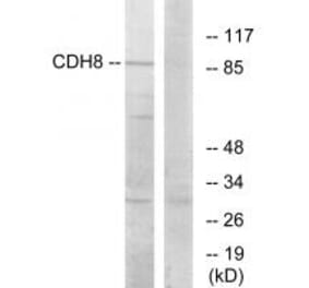 Western blot - CDH8 Antibody from Signalway Antibody (34180) - Antibodies.com